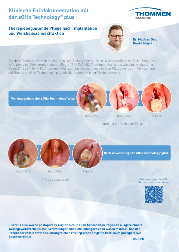 Fo_01d367_Clinical_Case_sOHo_Geib_DE.pdf