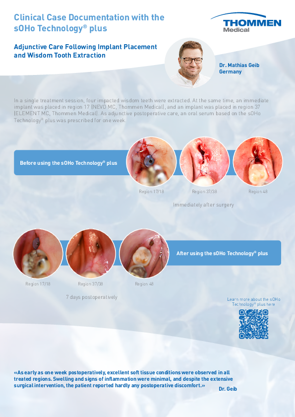 Fo_02d367_Clinical_Case_sOHo_Geib_EN.pdf