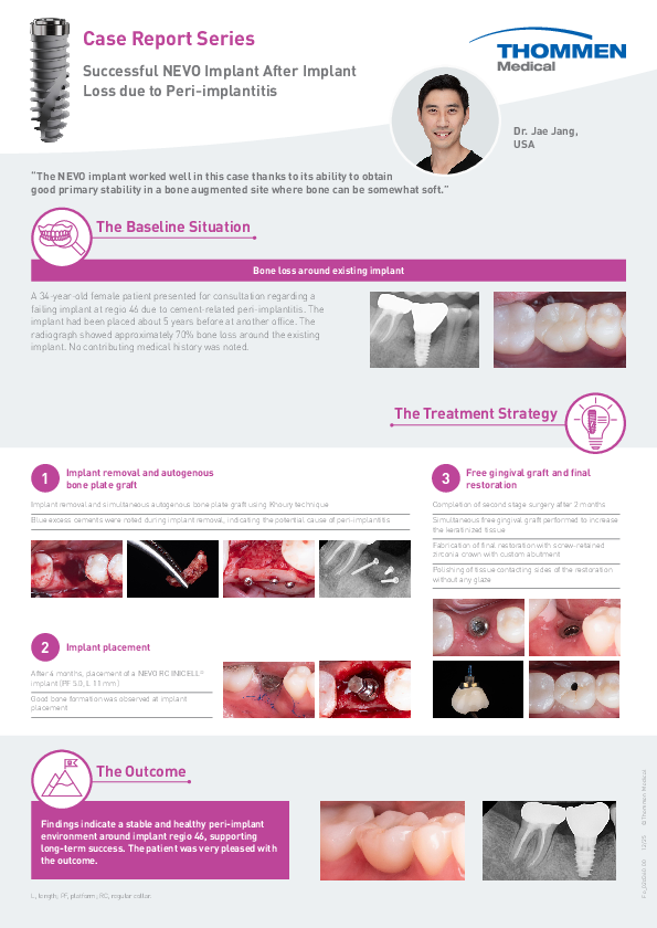 Fo_02d360_Clinical_Case_Jang_NEVO_Healed_Ridge_after_Bone_Grafting_00.pdf