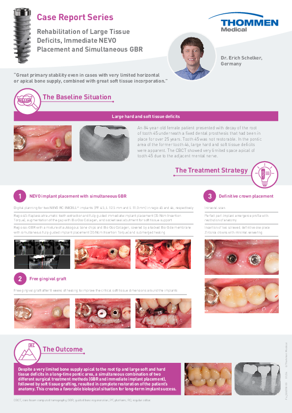 Fo_02d358_Clinical_Case_Schelker_Immediate_NEVO_GBR_K3.pdf